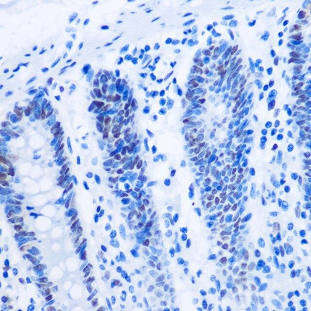 Anti-Asymmetric DiMethyl-Histone H3-R8 antibody produced in rabbit
