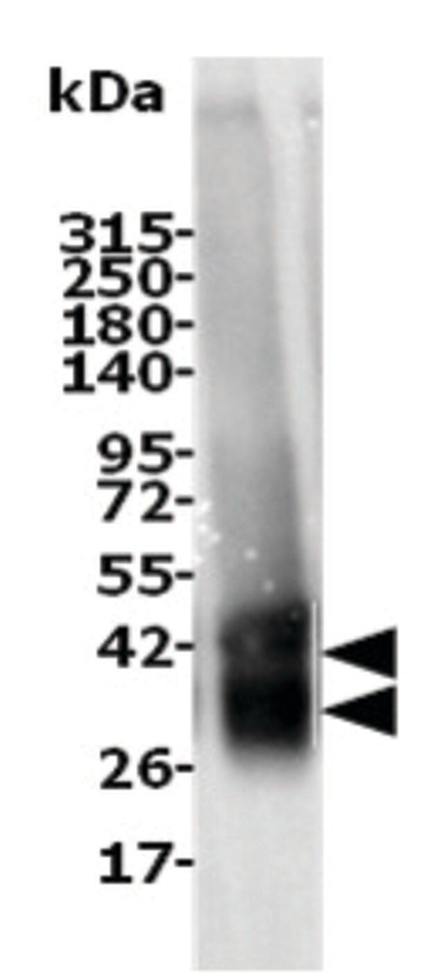 A2A (Adenosine Receptor A2A)