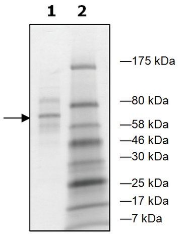 AEBP2 human