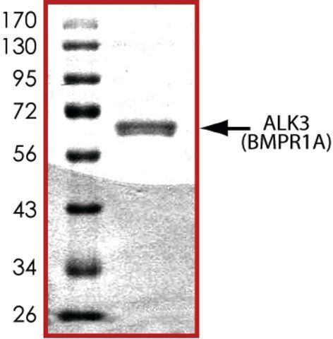 ALK3 (187-end), active, GST tagged human