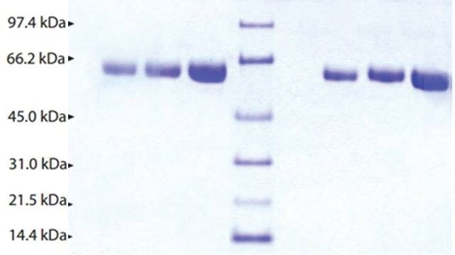 Alpha 2 Antiplasmin from human plasma