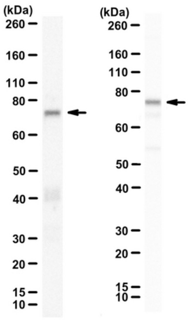 Ant-Zyxin