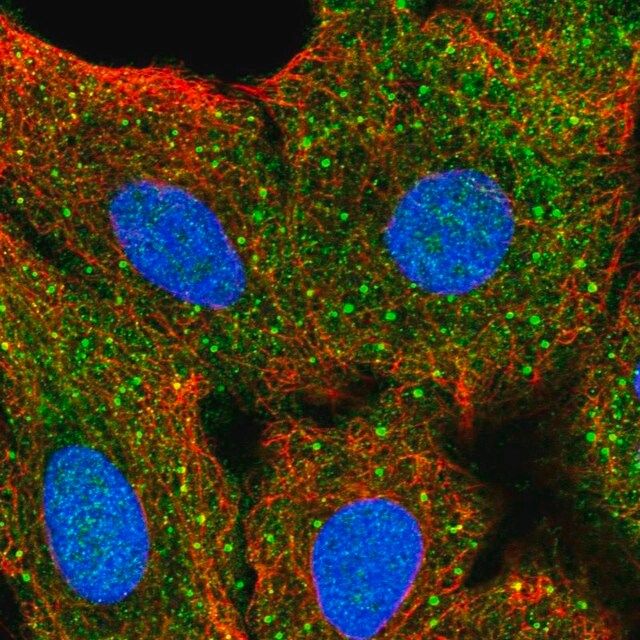 Anti-AKT2 antibody produced in rabbit