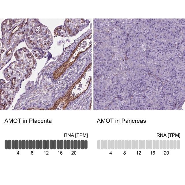 Anti-AMOT antibody produced in rabbit