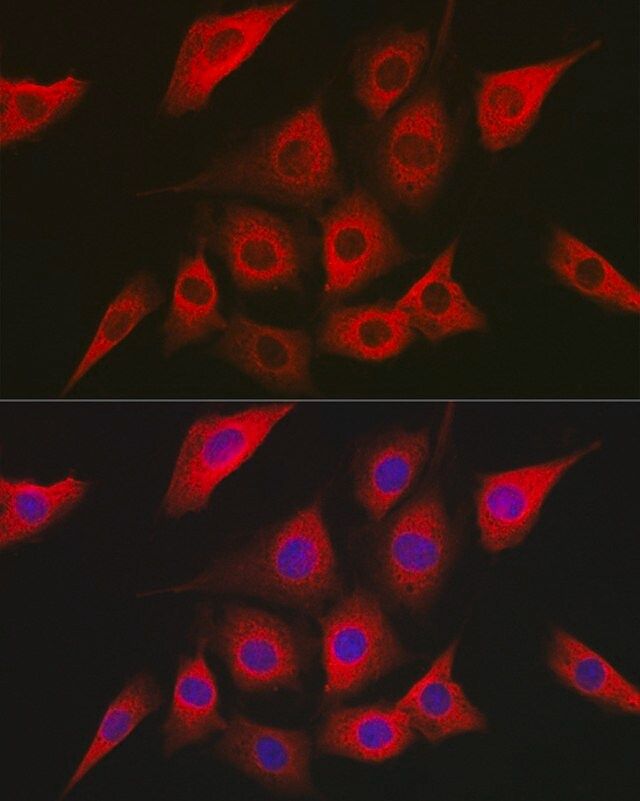 Anti- AMPKα2 antibody produced in rabbit