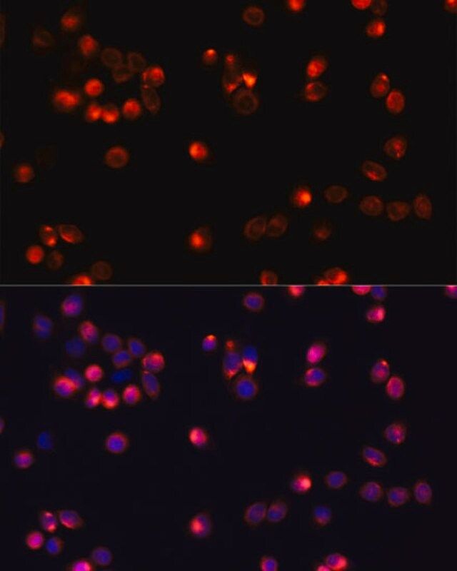 Anti-AKT2 antibody produced in rabbit