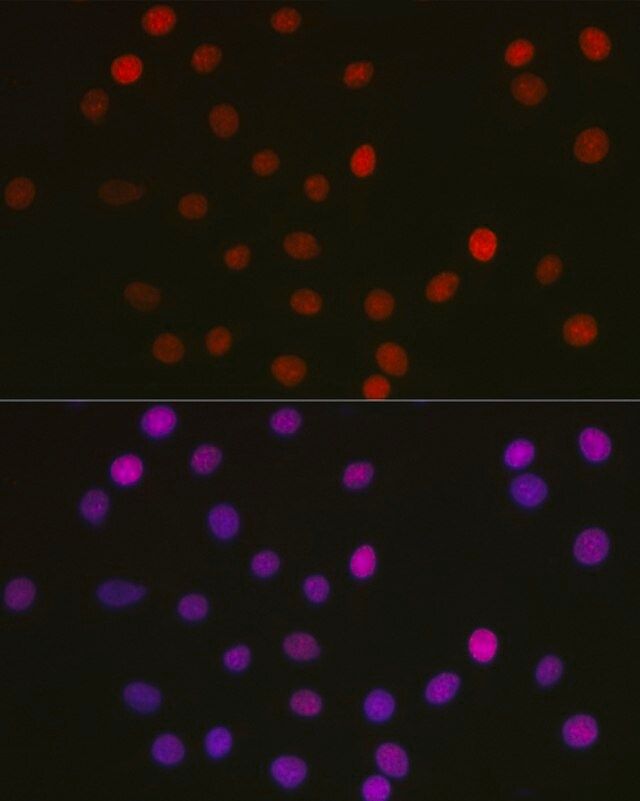 Anti- Acetyl-HMGB1-K29 antibody produced in rabbit