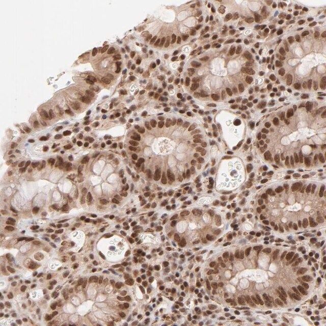 Anti-CTCF antibody produced in rabbit
