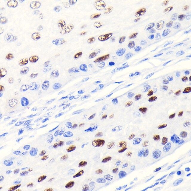 Anti- CDKN1A/p21CIP1 antibody produced in rabbit