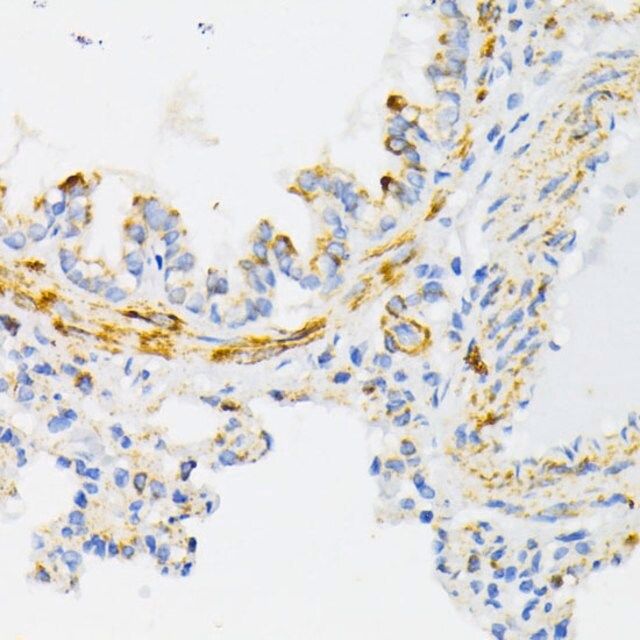 Anti-Cytochrome c antibody produced in rabbit