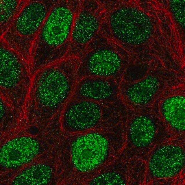 Anti-CIRBP antibody produced in rabbit