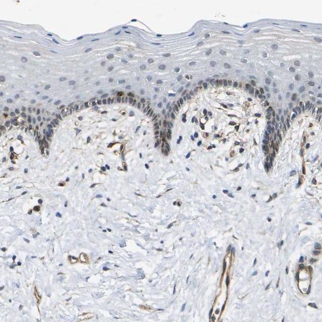 Anti-ECE1 antibody produced in rabbit
