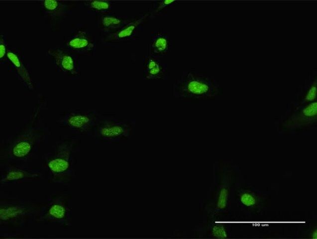 Anti-CIRBP antibody produced in rabbit