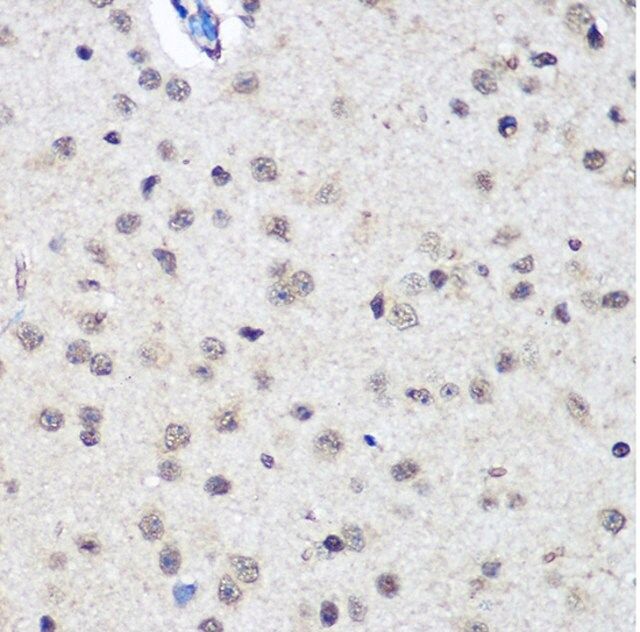 Anti-CTCF antibody produced in rabbit