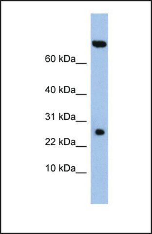 Anti-ZSWIM3, (N-terminal) antibody produced in rabbit