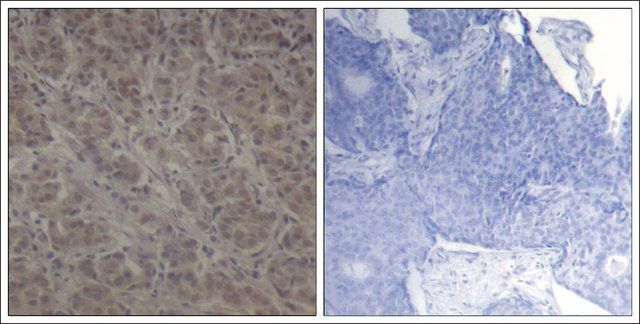 Anti-RPS6KA1 (Ab-352) antibody produced in rabbit