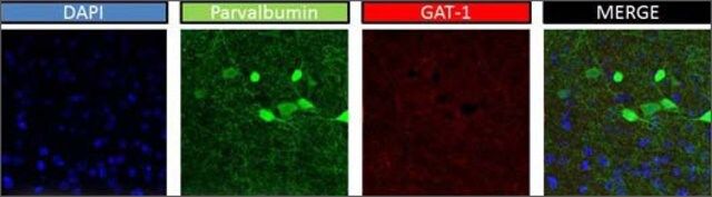 Anti-SLC6A1 antibody produced in rabbit