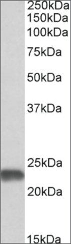 Anti-SOD2 antibody produced in goat