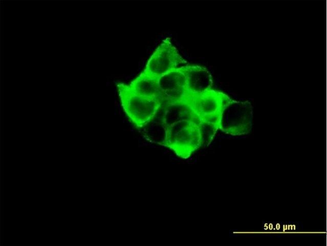 ANTI-RPS6KB1 antibody produced in mouse