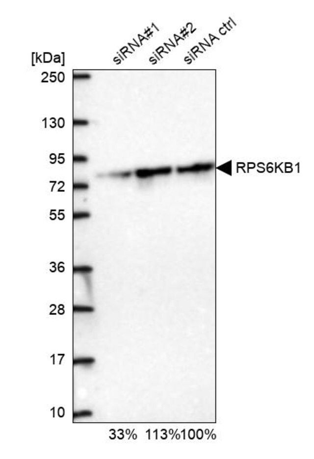 Anti-RPS6KB1 antibody produced in rabbit