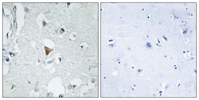 Anti-SAPK antibody produced in rabbit