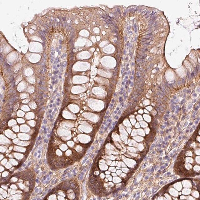 Anti-SOS2 antibody produced in rabbit