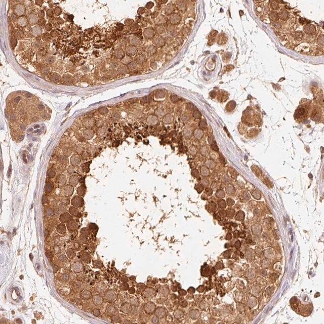 Anti-RRAS2 antibody produced in rabbit