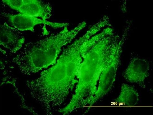 ANTI-RPS6KB1 antibody produced in mouse