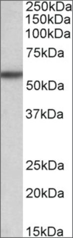 Anti-TGFBR1 antibody produced in goat