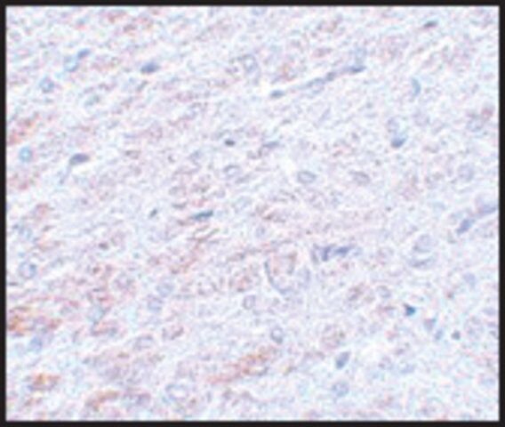 Anti-TCF3 antibody produced in rabbit