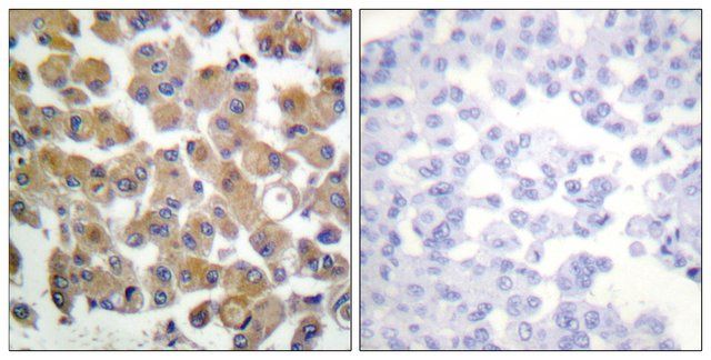 Anti-TGF β1 antibody produced in rabbit