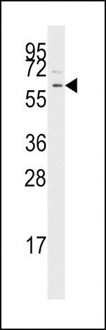 ANTI-TGF BETA RECEPTOR I (CENTER) antibody produced in rabbit