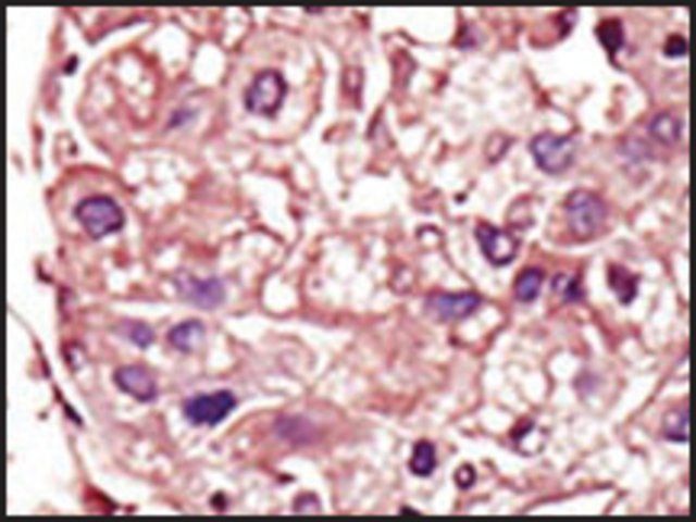 Anti-TGFBR1 (center) antibody produced in rabbit