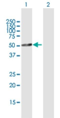Anti-TFDP2 antibody produced in rabbit