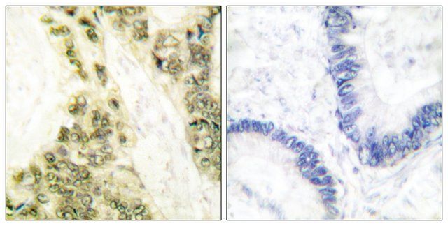 Anti-Thyroid Hormone Receptor α, N-Terminal antibody produced in rabbit