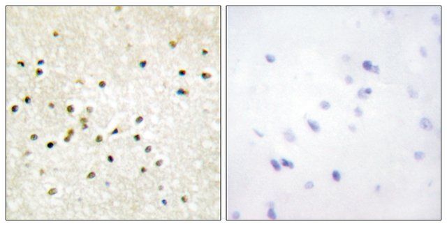 Anti-TF2H1 antibody produced in rabbit