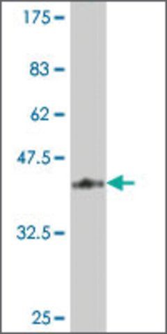 ANTI-TIE1 antibody produced in mouse