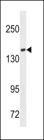 ANTI-TIAM1(C-TERMINAL) antibody produced in rabbit