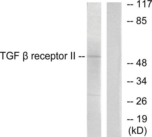 Anti-TGF β Receptor II antibody produced in rabbit
