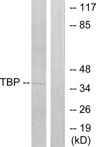 Anti-TBP antibody produced in rabbit