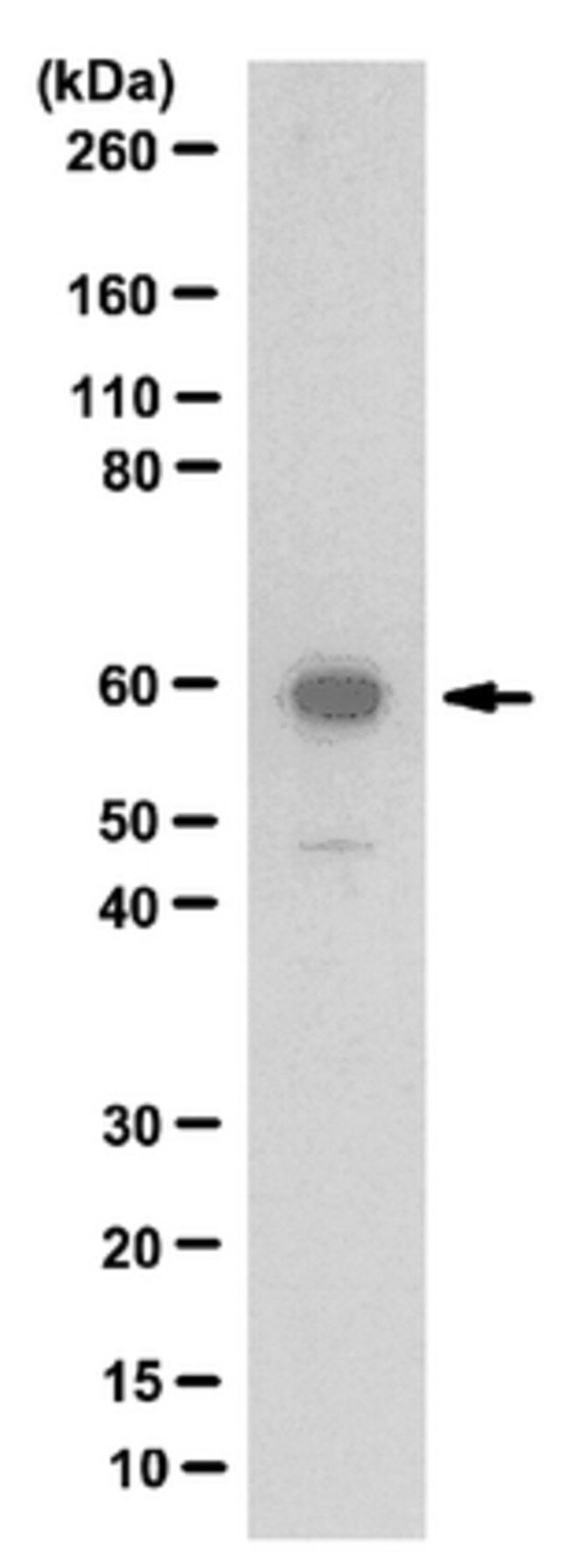 Anti-Thyroid Hormone Receptor β-1 Antibody
