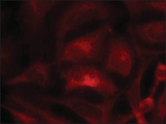 Anti-RAC1 (Ab-71) antibody produced in rabbit