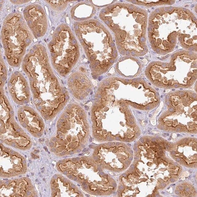 Anti-RNF31 antibody produced in rabbit