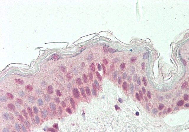 Anti-RARG antibody produced in rabbit