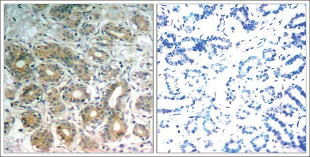 Anti-PTPN11 (Ab-542) antibody produced in rabbit