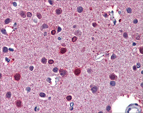 Anti-RARB antibody produced in rabbit