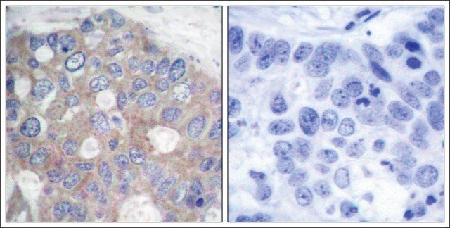 Anti-RPS6KB1 (Ab-421) antibody produced in rabbit