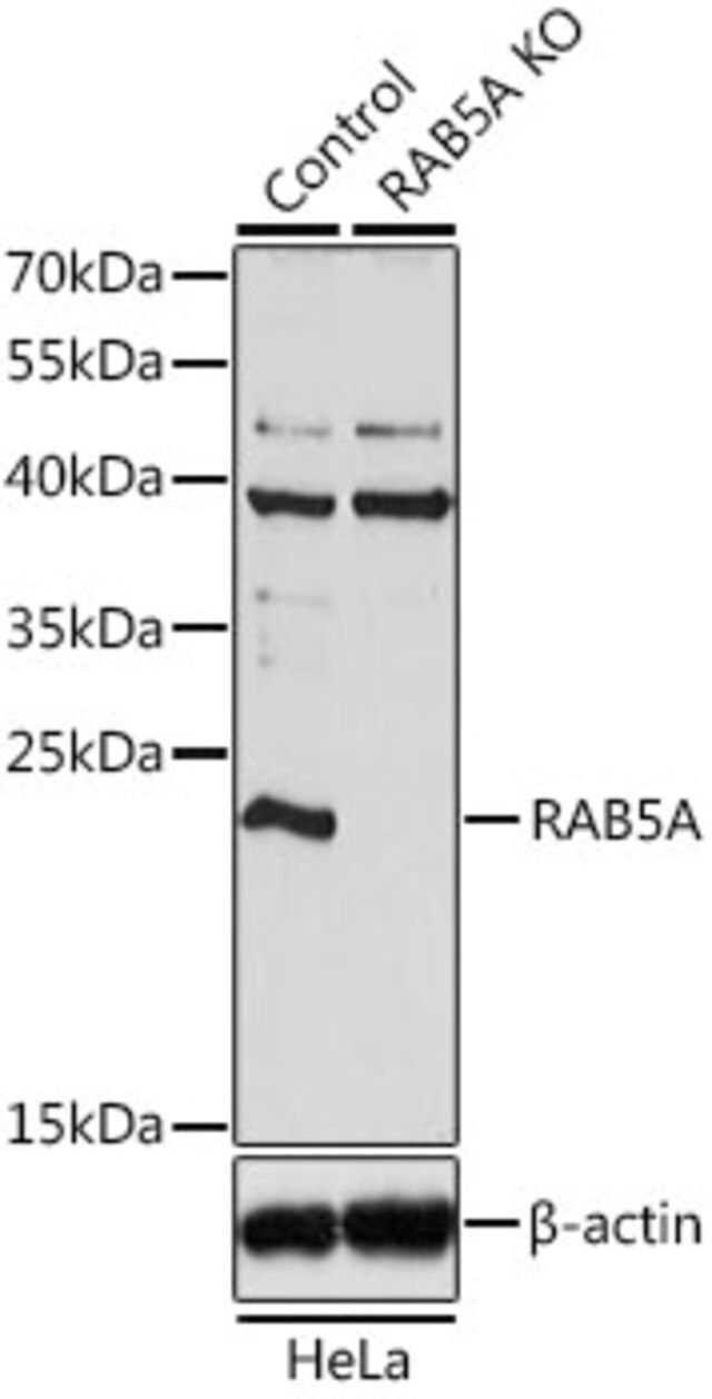 Anti-RAB5A antibody produced in rabbit