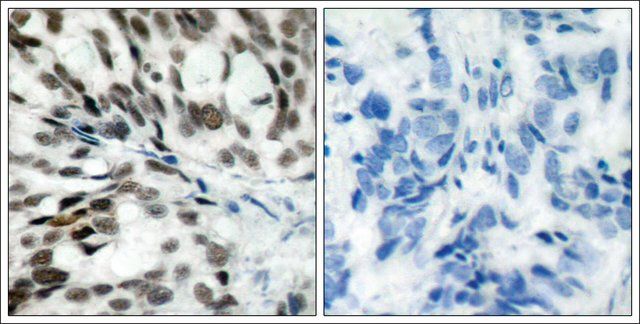 Anti-RB1 (Ab-780) antibody produced in rabbit