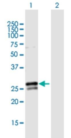 Anti-RAB3B antibody produced in mouse
